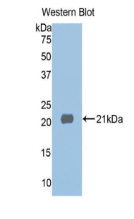 Polyclonal Antibody to Histone Deacetylase 6 (HDAC6)