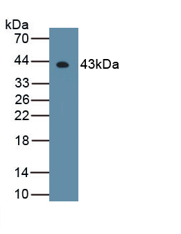 Polyclonal Antibody to Histone Deacetylase 11 (HDAC11)