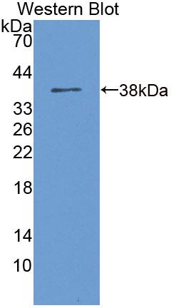 Polyclonal Antibody to Eukaryotic Elongation Factor 2 Kinase (EEF2K)