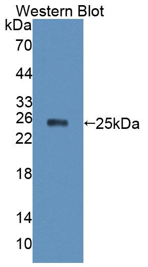 Polyclonal Antibody to Exportin 5 (XPO5)