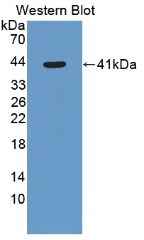 Polyclonal Antibody to 11-Beta-Hydroxysteroid Dehydrogenase Type 2 (HSD11b2)