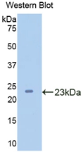 Polyclonal Antibody to Carboxypeptidase N1 (CPN1)