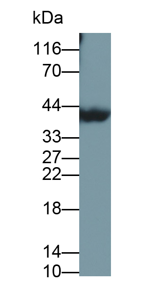 Polyclonal Antibody to Crystallin Lambda 1 (CRYl1)