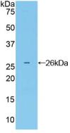 Polyclonal Antibody to Growth Factor Receptor Bound Protein 7 (Grb7)