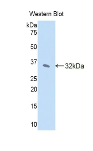 Polyclonal Antibody to Janus Kinase 2 (JAK2)