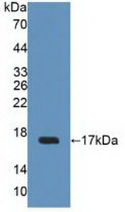Polyclonal Antibody to Uroplakin 2 (UPK2)