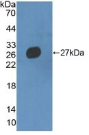 Polyclonal Antibody to Multimerin 2 (MMRN2)