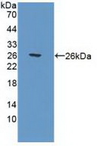 Polyclonal Antibody to Polymerase DNA Directed Gamma 1 (POLg1)