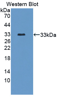 Polyclonal Antibody to Transient Receptor Potential Cation Channel Subfamily V, Member 2 (TRPV2)