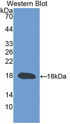 Polyclonal Antibody to Transient Receptor Potential Cation Channel Subfamily V, Member 3 (TRPV3)