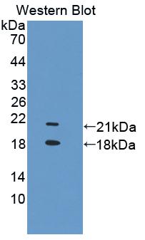 Polyclonal Antibody to Transient Receptor Potential Cation Channel Subfamily V, Member 6 (TRPV6)