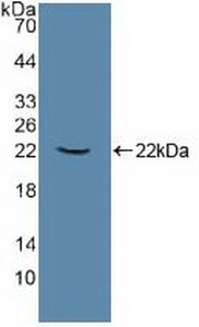 Polyclonal Antibody to ATPase, Na+/K+ Transporting Alpha 1 Polypeptide (ATP1a1)