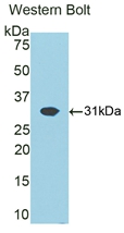 Polyclonal Antibody to ATPase, Na+/K+ Transporting Beta 1 Polypeptide (ATP1b1)