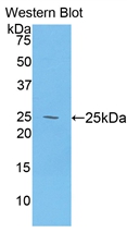 Polyclonal Antibody to Desmocollin 1 (DSC1)