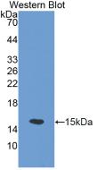 Polyclonal Antibody to Solute Carrier Family 30, Member 5 (SLC30A5)