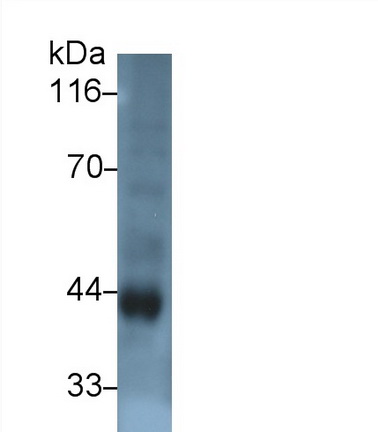 Polyclonal Antibody to Arylsulfatase B (ARSB)
