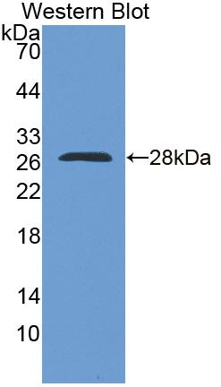 Polyclonal Antibody to RNA Binding Motif Protein 38 (RBM38)
