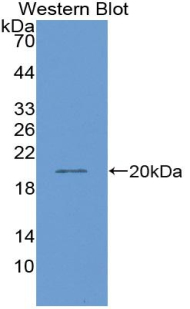 Polyclonal Antibody to Hepatocyte Nuclear Factor 1 Beta (HNF1b)