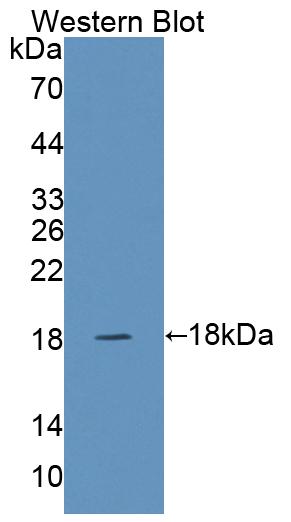 Polyclonal Antibody to SNAP Associated Protein (SNAPAP)