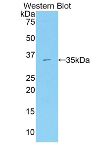 Polyclonal Antibody to Peroxisome Proliferator Activated Receptor Gamma Coactivator 1 Alpha (PPARgC1a)