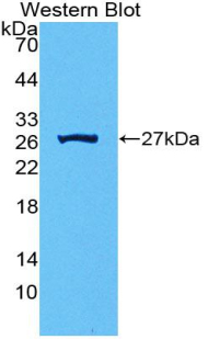 FITC-Linked Polyclonal Antibody to Nicotinamide-N-Methyltransferase (NNMT)