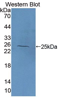 Biotin-Linked Polyclonal Antibody to N-Acetylgalactosaminidase Alpha (NAGa)