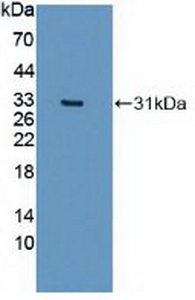 Polyclonal Antibody to Iron Responsive Element Binding Protein 2 (IREB2)