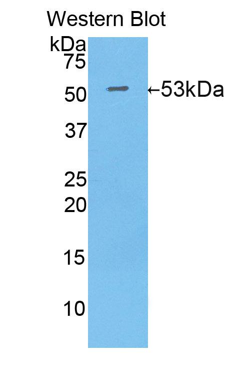 Polyclonal Antibody to Isocitrate Dehydrogenase 1, Soluble (IDH1)