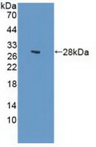 Polyclonal Antibody to Guanylate Cyclase 1 Beta 3 (GUCY1b3)