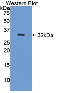 Polyclonal Antibody to DNA Methyltransferase 1 (DNMT1)