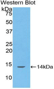 Polyclonal Antibody to D-Aspartate Oxidase (DDO)