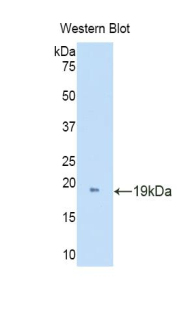 Polyclonal Antibody to D-Aspartate Oxidase (DDO)