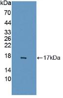 Polyclonal Antibody to GABA-A Receptor Associated Protein Like Protein 2 (GABARAPL2)