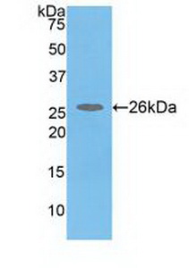 Polyclonal Antibody to Catechol-O-Methyltransferase (COMT)