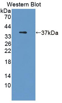Polyclonal Antibody to Chitinase 3 Like Protein 2 (CHI3L2)