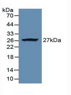 Polyclonal Antibody to Enhancer Of Zeste Homolog 2 (EZH2)