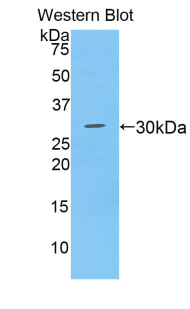 Polyclonal Antibody to A Disintegrin And Metalloprotease 28 (ADAM28)