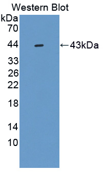Polyclonal Antibody to A Disintegrin And Metalloproteinase With Thrombospondin 5 (ADAMTS5)