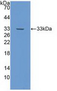 Polyclonal Antibody to Notch Homolog 4 (NOTCH4)