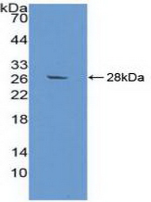 Polyclonal Antibody to Alpha-2-Glycoprotein 1, Zinc Binding (aZGP1)
