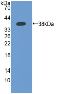 Polyclonal Antibody to Interferon Inducible Protein 35 (IFI35)