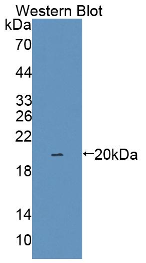 Polyclonal Antibody to Interleukin 1 Family, Member 9 (IL1F9)
