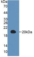 Polyclonal Antibody to Microtubule Associated Protein 1 Light Chain 3 Alpha (MAP1LC3a)