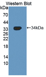 Polyclonal Antibody to NUAK Family SNF1 Like Kinase 1 (NUAK1)