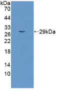 Polyclonal Antibody to SCO Cytochrome Oxidase Deficient Homolog 2 (SCO2)