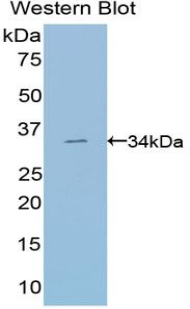 Polyclonal Antibody to Suppressor Of Variegation 4-20 Homolog 2 (SUV420H2)