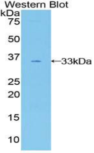 Polyclonal Antibody to GRB2 Associated Binding Protein 3 (GAB3)
