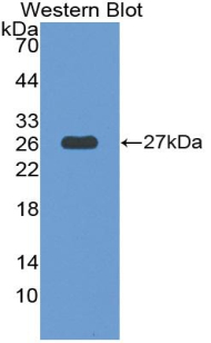 Polyclonal Antibody to Thrombospondin Type I Domain Containing Protein 7A (THSD7A)
