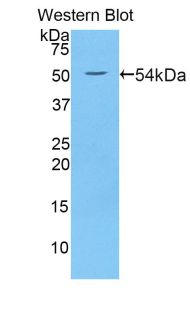 Polyclonal Antibody to Wingless Type MMTV Integration Site Family, Member 10A (WNT10A)