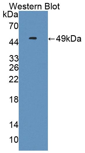 Polyclonal Antibody to Interferon Alpha 11 (IFNa11)
